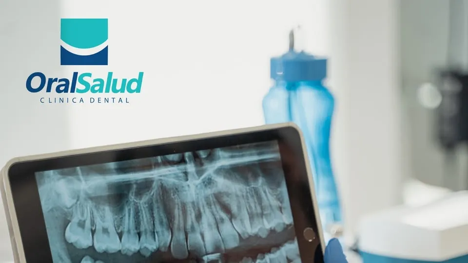 Oral salud
