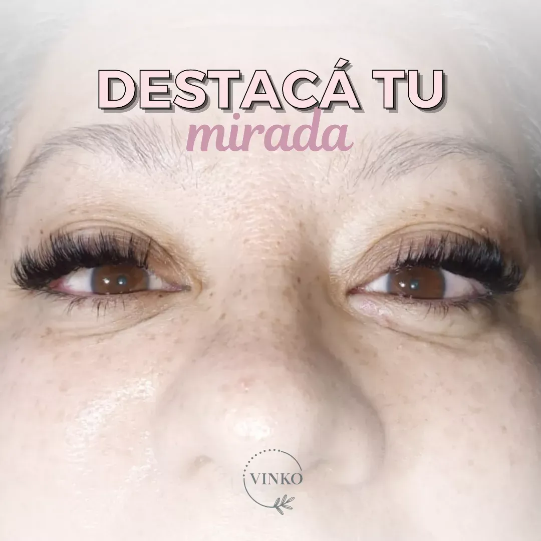 Vinko Centro de Estética