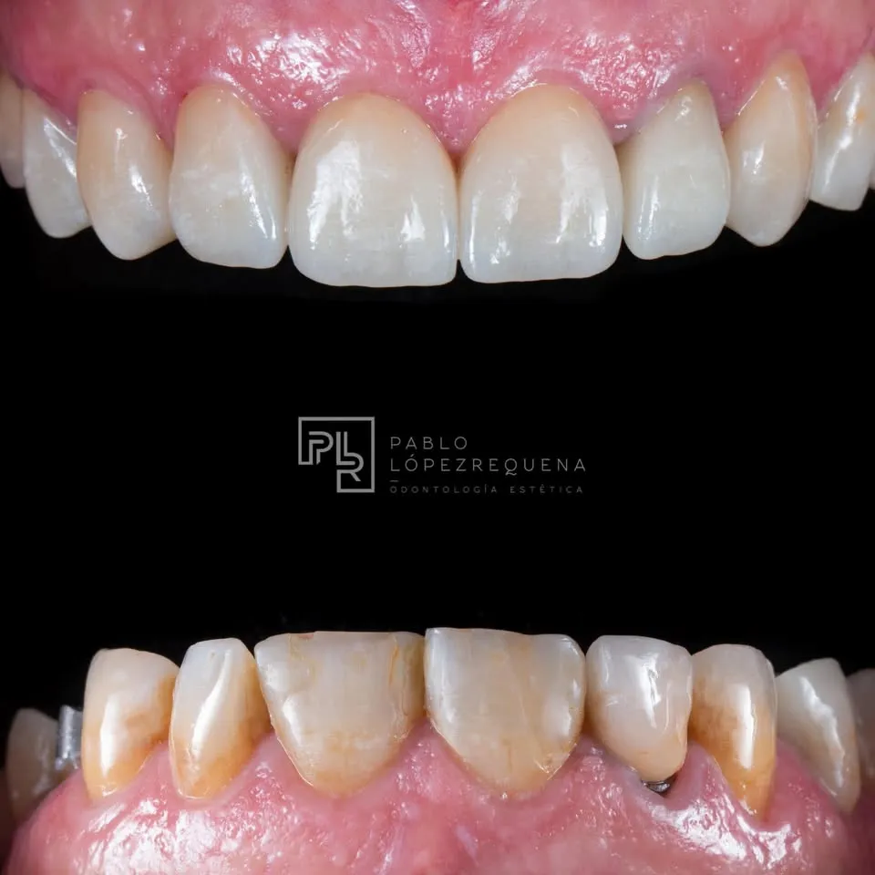 Odontologia Estética - Pablo Lopez Requena