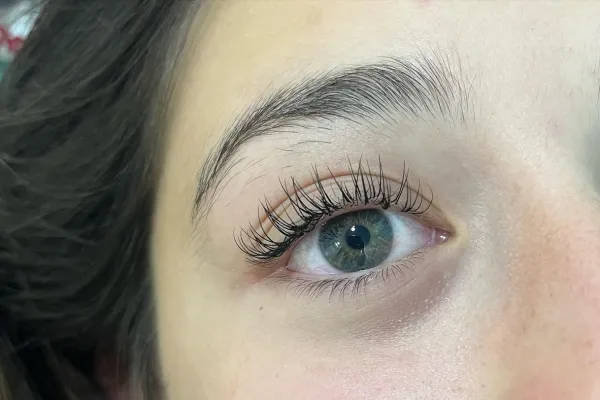 Mylha estética corporal y facial