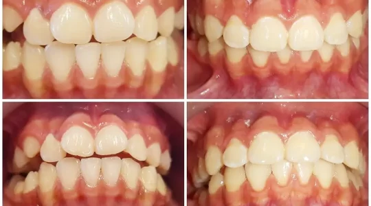 dentibrack 1780521305623